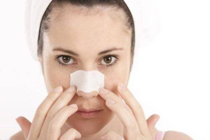blackheads, skin care tips, skin care