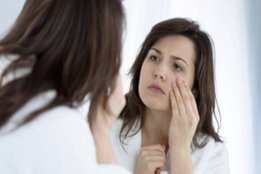 dark circles, beauty tips, beauty