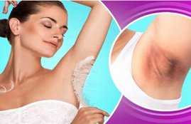 Dark Underarms, Lifestyle, Lifestyle News