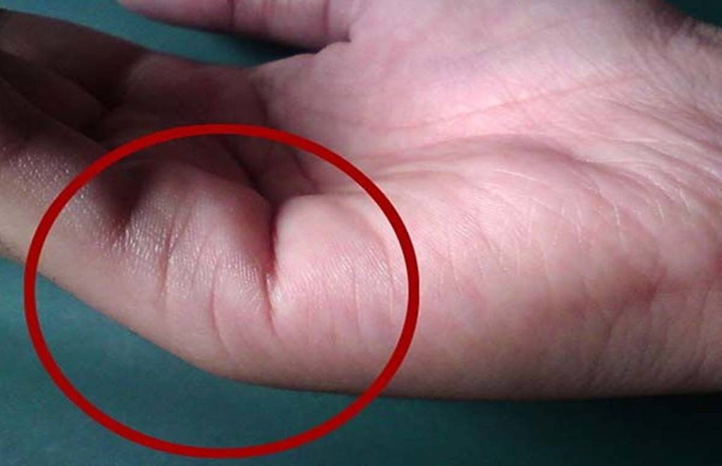Marriage Line, palmistry Marriage Line, palm reading, hasth rekha shastra, marriage line prediction,