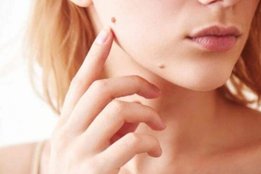 warts, lifestyle, lifestyle news