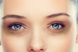 Dark circle, Beauty tips, dark circle home remedies