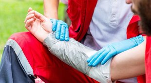 burn remedies, burn home remedies, how to treat burns