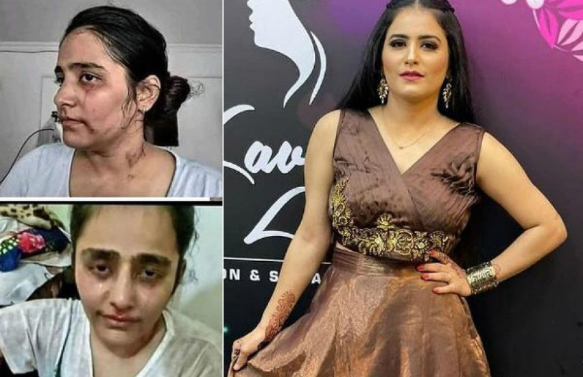 प्रीति का आरोप है कि अब उनका पति धर्म बदलने के नाम पर उनके साथ जबरदस्ती करने के साथ ही उनके साथ मारपीट करने लगा था। ( बेटे-बेटी के लिए इन पॉलिटिशियन्स ने तोड़ी धर्म की दीवार, किसी के हिंदू तो किसी के मुस्लिम हैं बहू-दामाद )