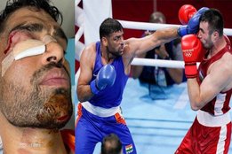 tokyo-olympics-satish-kumar-fought-his-quarterfinal-bout-with-several-stiches-on-his-face-lost-match-but-won-millions-of-hearts