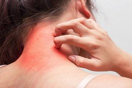 skincare tips, skin tips, beauty tips, skin infection, rashes