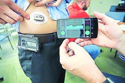 कृत्रिम ‘पैंक्रियाज’, जो बचाएगा ‘डायलिसिस’ से