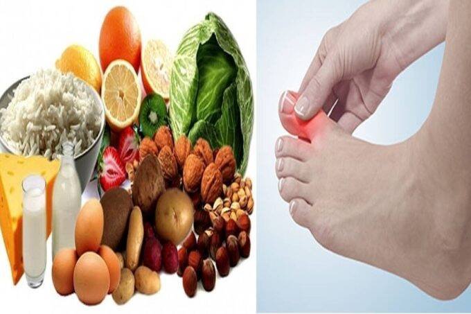 Uric Acid, high uric acid, uric acid remedy