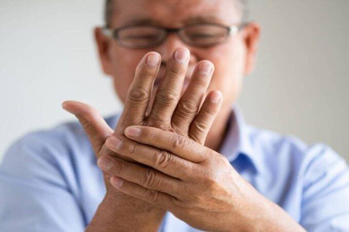 High Uric Acid, Uric Acid, blood test, urine test