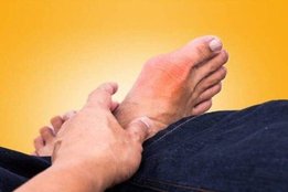 Uric Acid, uric acid symptoms, high uric acid problem