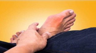 Health, Health News, Gout