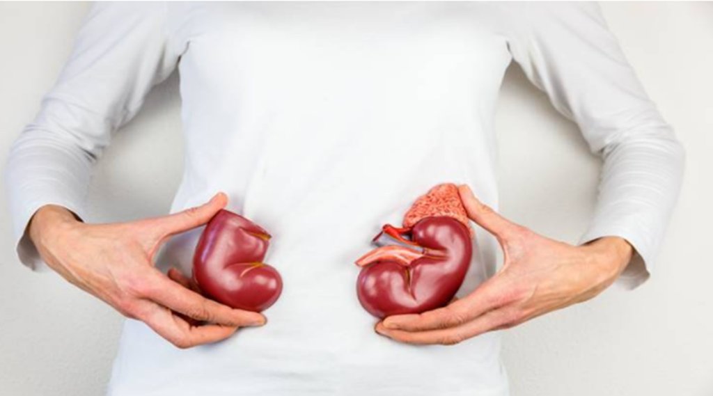 Kidney Stone, Health, Health News