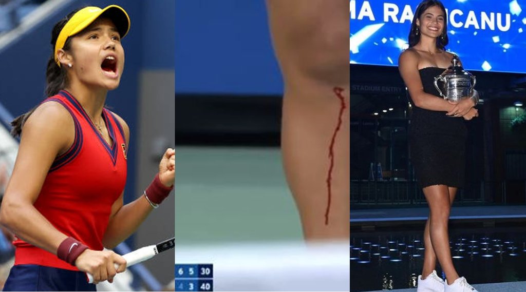 us-open-18-years-old-emma-raducanu-won-grand-slam-even-after-blooding-she-won-each-and-every-set-throughout-tournament