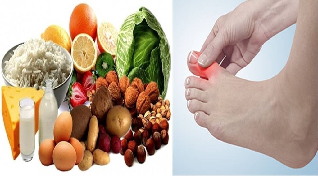uric acid, uric acid diet, uric acid food to avoid