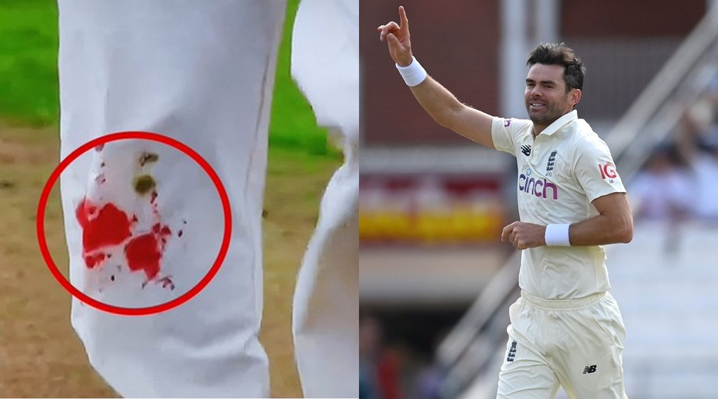 ind-vs-eng-james-anderson-continues-bowling-with-blooded-knee-and-pant-gets-red-photos-viral-from-oval-test