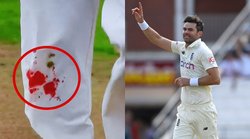 जेम्स एंडरसन ने घुटने से खून बहने के बावजूद जारी रखी गेंदबाजी, कैसे लगी अंग्रेज दिग्गज के चोट; सोशल मीडिया पर वायरल हुई फोटो