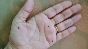 body moles, hand moles meaning, moles prediction, tilo ka arth, samudrik shastra, face moles astrology,