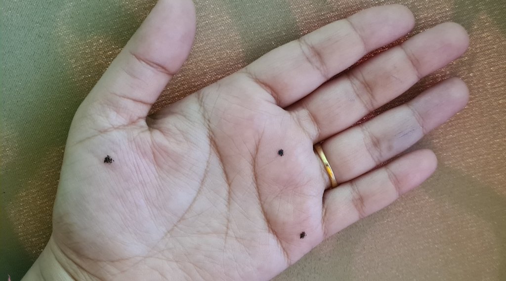 body moles, hand moles meaning, moles prediction, tilo ka arth, samudrik shastra, face moles astrology,
