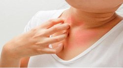 Skin Care: त्वचा की खुजली को न करें नजरअंदाज, हो सकता है AD, जानिये सबकुछ