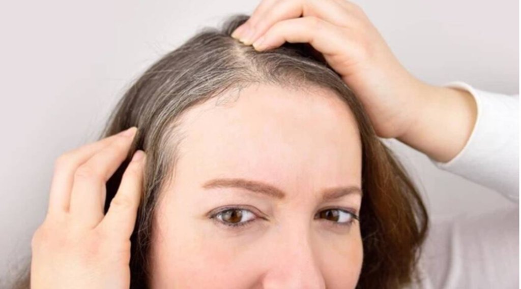 Lifestyle News, White Hair, Home Remedies For White Hair