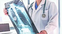 क्षय रोग से सबसे ज्यादा 15 लाख मौत