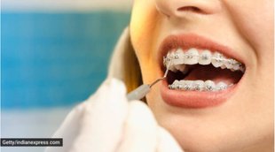 cavity, teeth cavity, oral health