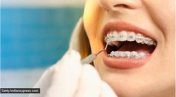 Teeth Cavity: बच्चों और युवाओं में बढ़ गई है दांतों के सड़न की समस्या! इन 3 उपायों से करें बचाव