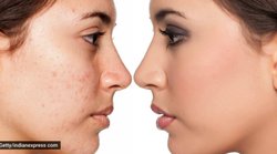 Skin Care: मेकअप में की गईं ये गलतियां बन सकती हैं पिंपल्स का कारण, इस तरह करें बचाव