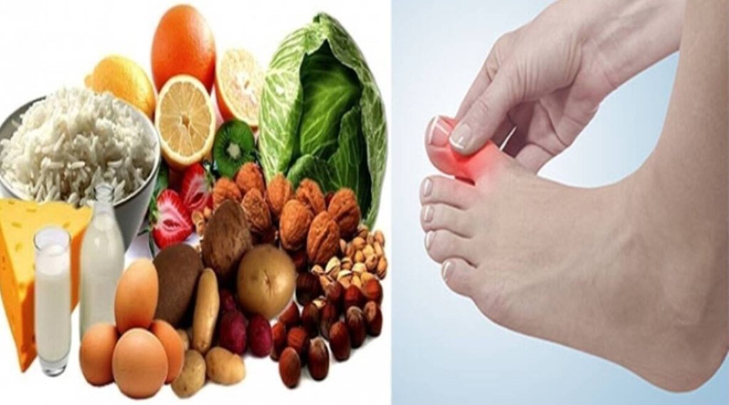 uric acid, uric acid treatment, how to control uric acid