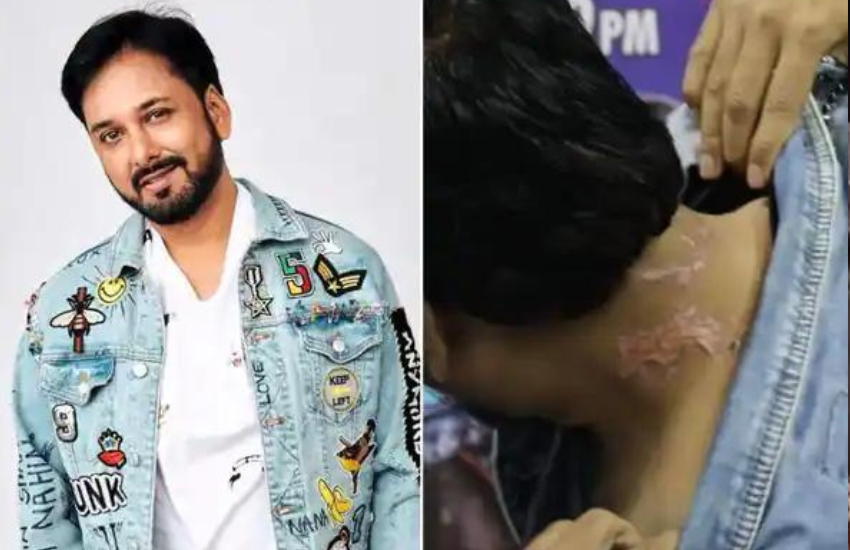 बिग बॉस के घर में एक टास्क करने के दौरान सिद्धार्थ डे की गरदन जल गई थी। कंटेस्टेंट्स ने सिद्धार्थ डे पर ब्लीच और लाल मिर्च का इस्तेमाल किया था। जिसकी वजह से सिद्धार्थ डे की गरदन पर चोट आ गई थी।