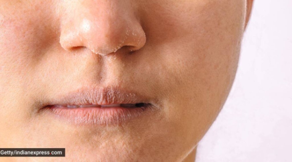 Skin Care, Lifestyle News, Lifestyle