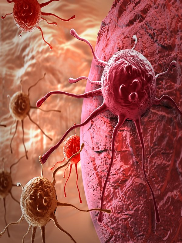 cancer cell