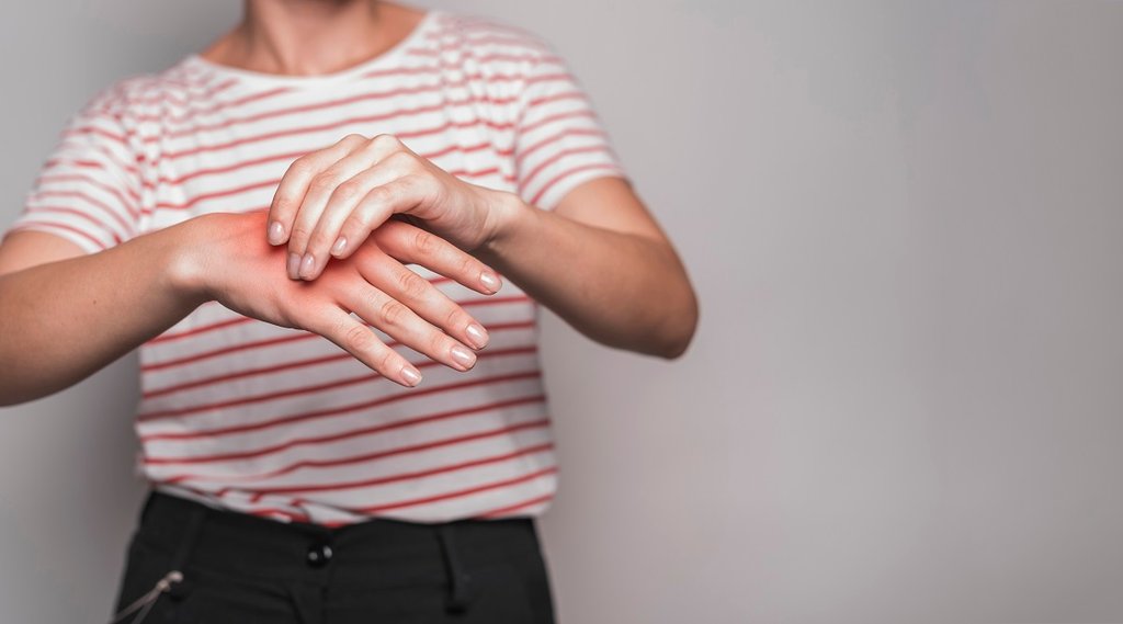 Body inflammation, inflammation Problems, Inflammation Caused Serious Disease, Inflammation Tips, Skin Problems, skin Inflammation, Body inflammation, inflammation Problems, Inflammation Caused Serious Disease, Inflammation Tips, Skin Problems, skin Inflammation,