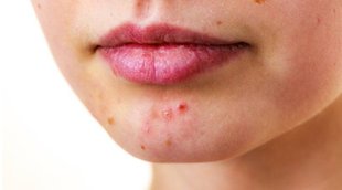 Lifestyle News, Skin Care, Beauty Tips