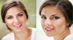 lucky moles, lucky moles on human body, samudrik shastra, face moles, tilo ka rehsya, moles, moles on ear,