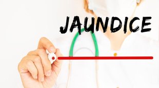 jaundice