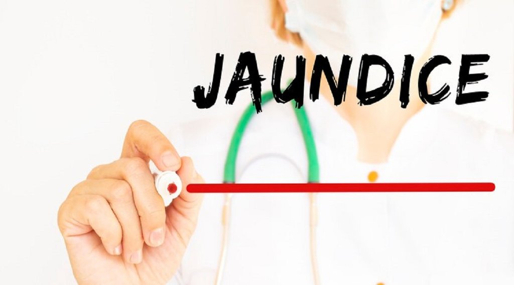 jaundice