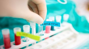 lassa virus