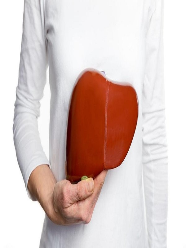 FATTY LIVER - DISEASE