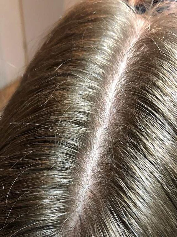 NEW HAIR GROWTH - Source @nadi.skininsta