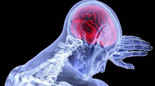 Dimentia, Disease, Health
