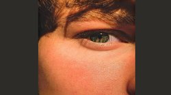 गर्मी के दिनों बढ़ सकती है त्वचा में खुजली की परेशानी, इन घरेलू उपायों से मिल सकता है छुटकारा; जानें