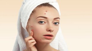 skin care tips, skin care tips,acne remove