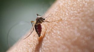Filariasis Symptoms,Filariasis Meaning,Filariasis Treatment,