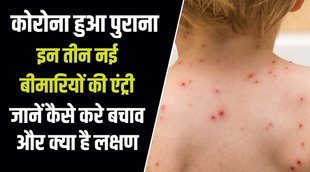 MONKEY POX , corona virus, tomato flu, who