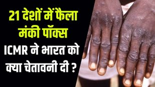monkeypox symptoms