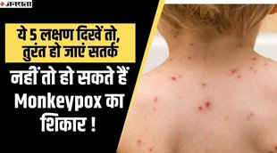 monkeypox virus,monkeypox,monkeypox virus symptoms,what is monkeypox,monkeypox outbreak,monkeypox symptoms,monkeypox virus treatment,monkeypox virus news,monkeypox virus structure,what is monkeypox virus