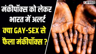 monkey pox virus