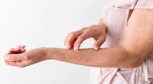 Kidney failure, Kidney failure, Early Warning Signs of Kidney Disease