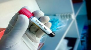 uric acid normal range,mail and femail uric acid normal range,tips to control uric acid